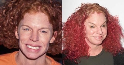 A picture of Carrot Top before (left) and after (right). 